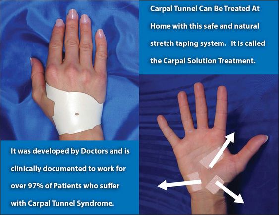 Kinesio Tape - 10 Bulk Right Hand Carpal Tunnel Treatment Kits